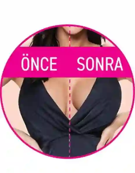 Resim Yeniinci 56 Kadın Göğüs Bandı